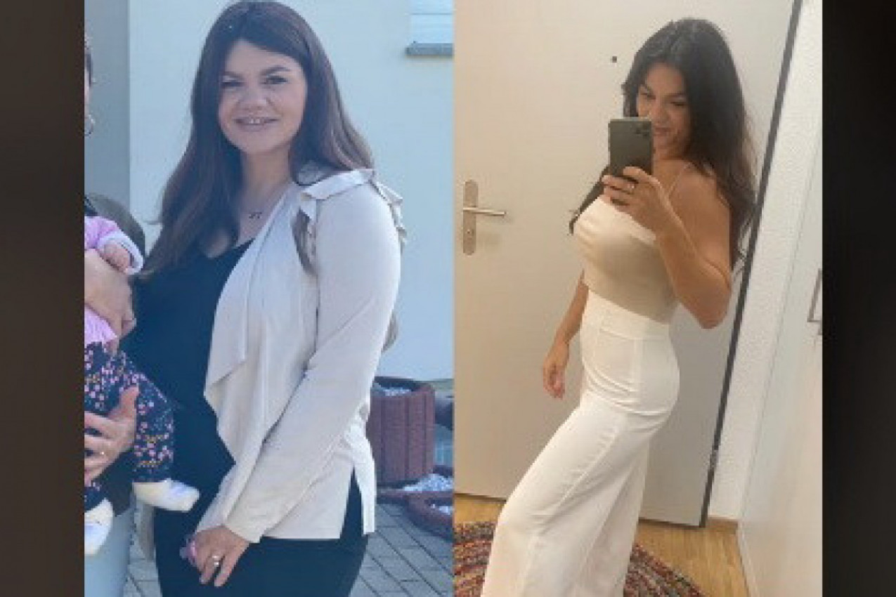 BEZ OPERACIJE ŽELUCA SMRŠALA 30 KILOGRAMA ZA 6 MESECI! Transformacija ove devojke je neverovatna, a evo šta je njena tajna!