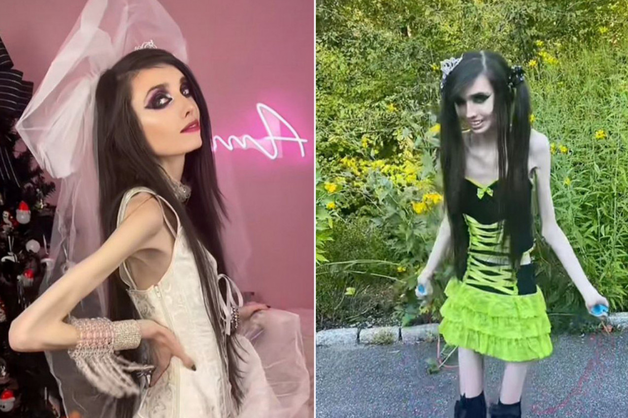 ŠOKANTNI SNIMCI NAJMRŠAVIJEG MODELA NA SVETU! Danas ima SAMO 39 kilograma i ne želi da ide na lečenje! (VIDEO)