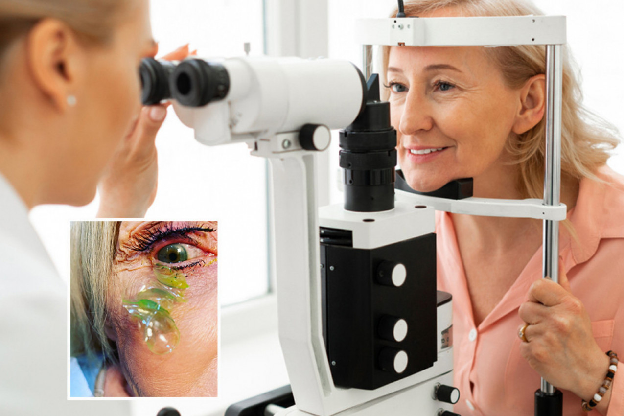 POŽALILA SE DA JOJ NEŠTO SMETA U OKU, bol je bio nepodnošljiv, pa je otišla kod lekara! A onda je usledilo šokantno otkriće, ono što je uradila je sve zaprepastilo! (FOTO/VIDEO)