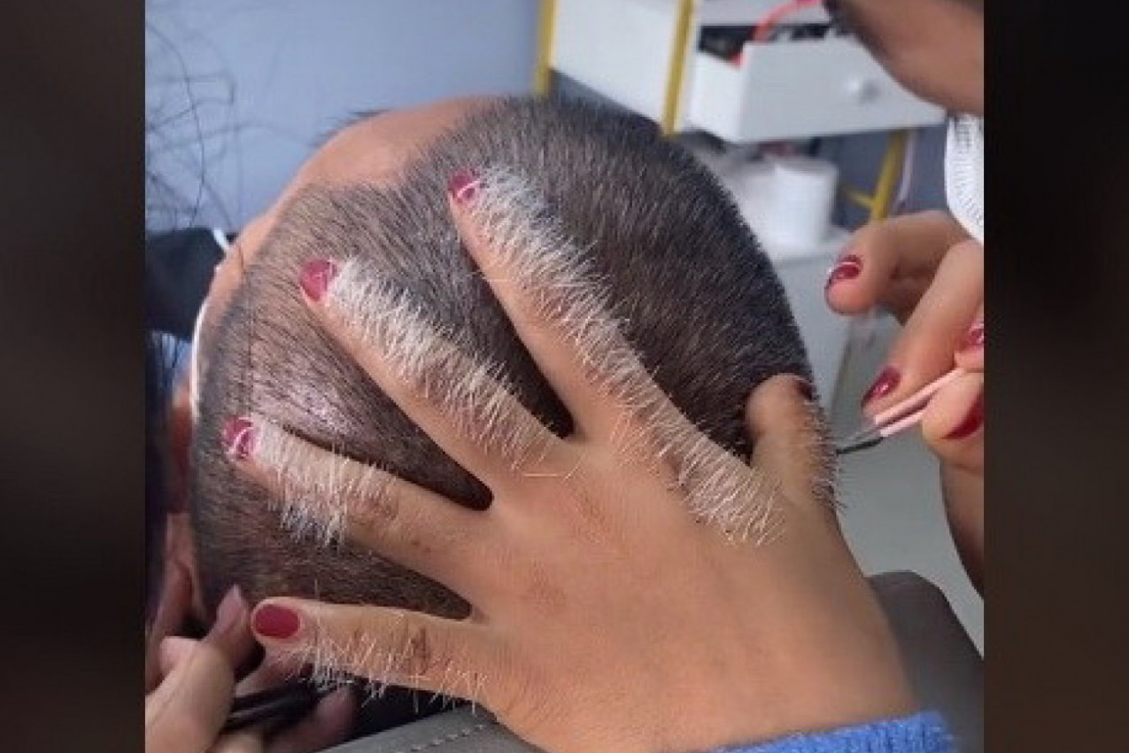 SKLONI JEDNU POJAVIĆE SE DESET! Ovaj čovek naišao na čuđenje i ismevanje Internet zajednice zbog poteza kod frizera!