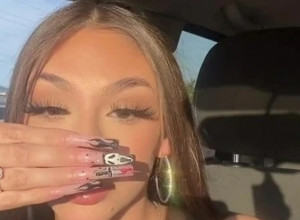 TIKTOKERKA S VELIKIM NOSEM KONAČNO OTKRILA SVOJ LIK: Govore mi da sam zbog njega nakaza, ali nije me briga! (FOTO)