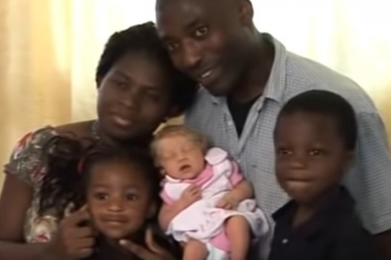 NIGERIJSKI PAR DOBIO BEBU PLAVE KOSE I OČIJU! Roditelji u šoku, čudo prirode: Kako je moguće da je ovo naša ćerka? (FOTO)