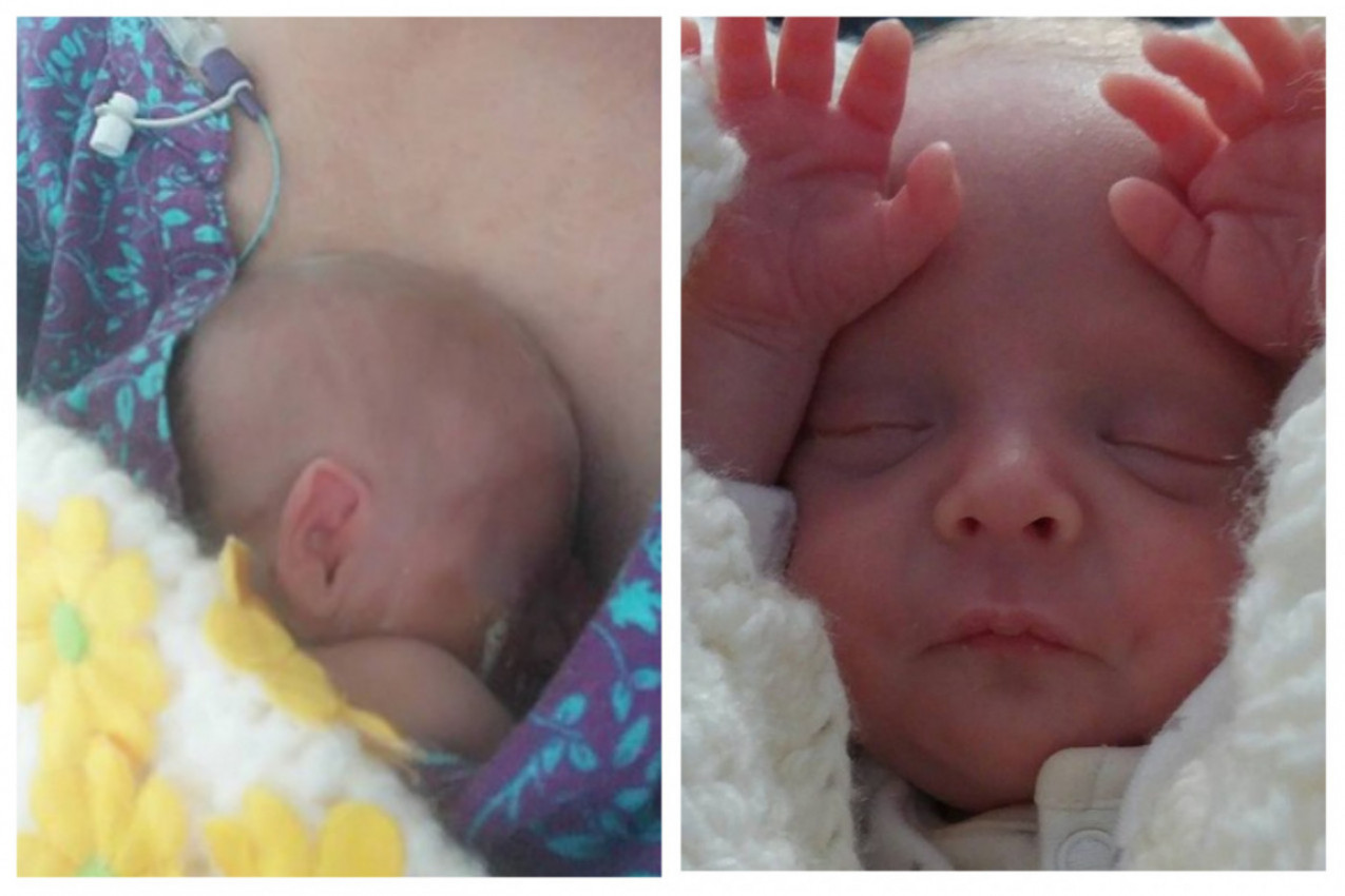 ROĐENA JE SA SAMO 600 GRAMA, a evo ko je ona danas! (FOTO)