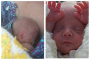 ROĐENA JE SA SAMO 600 GRAMA, a evo ko je ona danas! (FOTO)