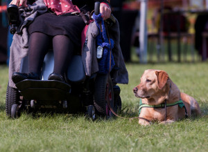 PRVI PUT JE OBOLELA KAD JE IMALA 11 GODINA, trpela je bolove i jedva se kretala, a lekari su rekli: Sve je umislila! Potresna ispovest žene koja ima jednu od najređih bolesti! (FOTO)