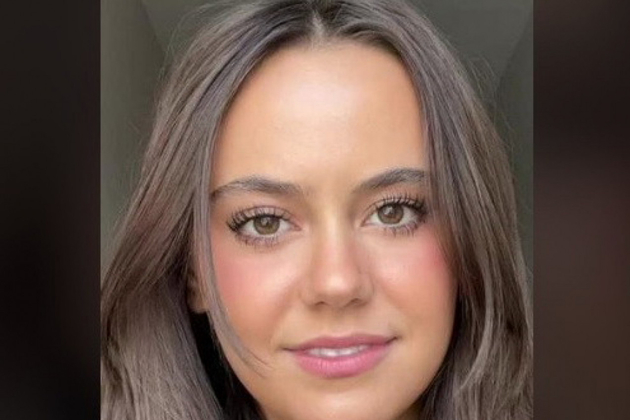 OVA LEPOTICA IMA MOŽDA I NAJVEĆE UŠI NA SVETU, A TEK ŠTA MOŽE DA RADI SA NJIMA: Nadrealni snimci manekenke obilaze svet, jednom objavom je posebno šokirala! (VIDEO)