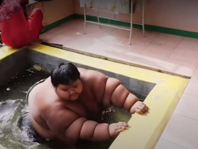 Roditelju su morali napolju da naprave bazen gde bi se kupao, pošto nije mogao da stane u tuš kabinu