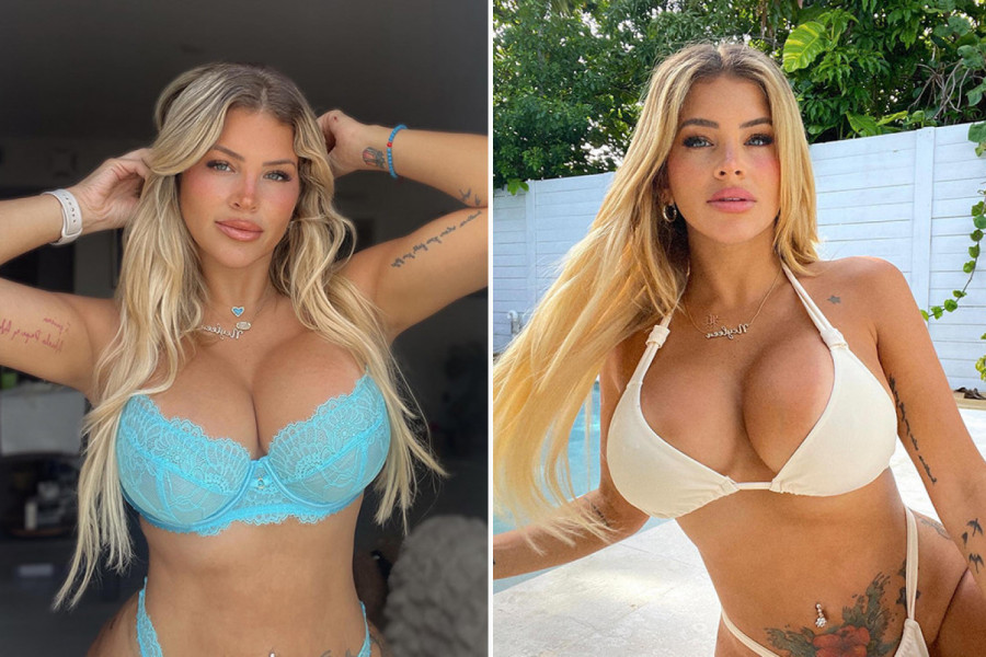 ZBOG OGROMNIH SILIKONSKIH GRUDI TRPI UŽASNE BOLOVE: Ova lepotica ne želi da smanji implante, a razlog je izazvao buru na internetu!(FOTO)