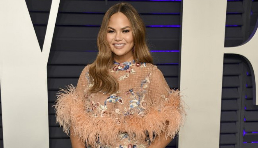 DA LI BISTE URADILI TRANSPLATACIJU OBRVA? Da, i to je moguće, evo kako izgleda čuvena manekenka koja se podvrgla toj intervenciji! (FOTO)