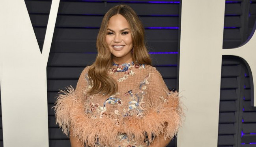 DA LI BISTE URADILI TRANSPLATACIJU OBRVA? Da, i to je moguće, evo kako izgleda čuvena manekenka koja se podvrgla toj intervenciji! (FOTO)