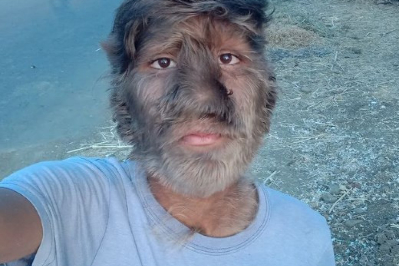 LJUDI SU ME GAĐALI KAMENJEM, DECA SU SE PLAŠILA DA IH NE UGRIZEM: Ispovest pravog dečaka vukodlaka dira direktno u srce (FOTO/VIDEO)