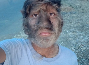 LJUDI SU ME GAĐALI KAMENJEM, DECA SU SE PLAŠILA DA IH NE UGRIZEM: Ispovest pravog dečaka vukodlaka dira direktno u srce (FOTO/VIDEO)