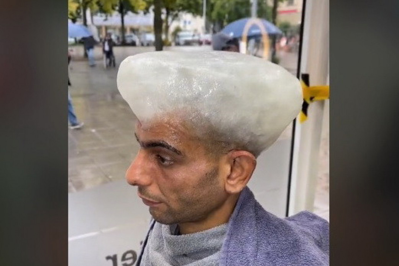 JEL ON JOŠ UVEK ŽIV? Javnost šokirana snimkom iz jednog frizerskog salona, mušterijama stavljaju led na glavu! (VIDEO)