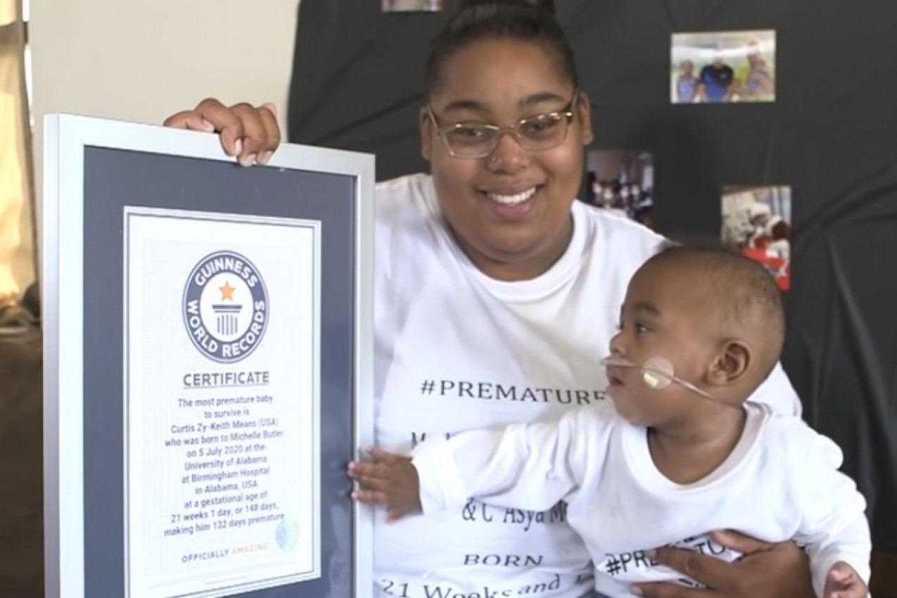 ON JE NAJRANIJE ROĐEN MALIŠAN NA SVETU KOJI JE PREŽIVEO: Prevremeno rođena beba imala je svega 420 grama, onda se desilo čudo! (FOTO/VIDEO)