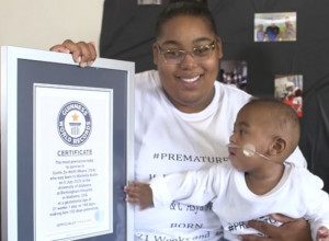 ON JE NAJRANIJE ROĐEN MALIŠAN NA SVETU KOJI JE PREŽIVEO: Prevremeno rođena beba imala je svega 420 grama, onda se desilo čudo! (FOTO/VIDEO)