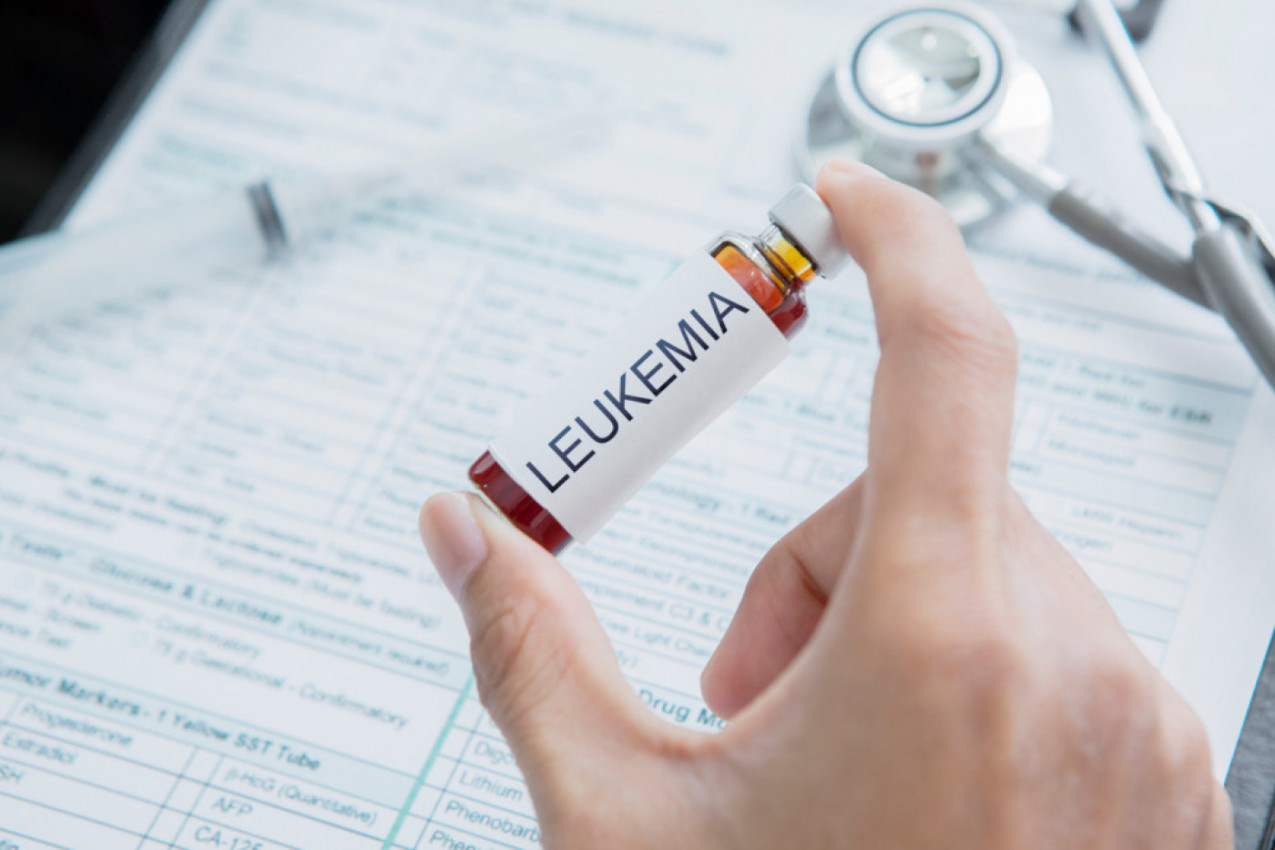 SIMPTOMI NASTANKA LEUKEMIJE: Ovo su prvi znaci na koje morate obratiti pažnju, upozoravaju stručnjaci!
