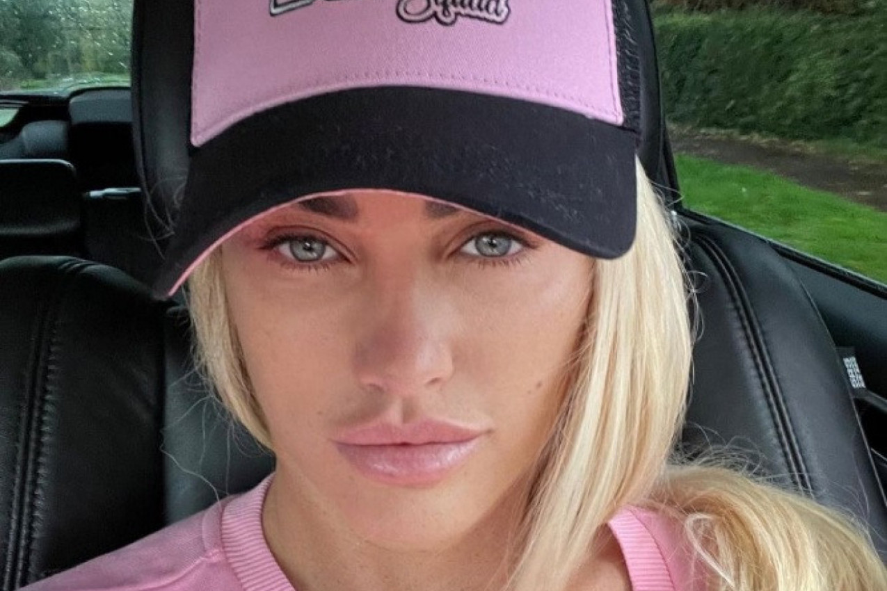 POTRESNE FOTOGRAFIJE STARLETE IZ BOLNICE! Šesnaesti put operisala grudi jer hoće najveće u zemlji! (FOTO)