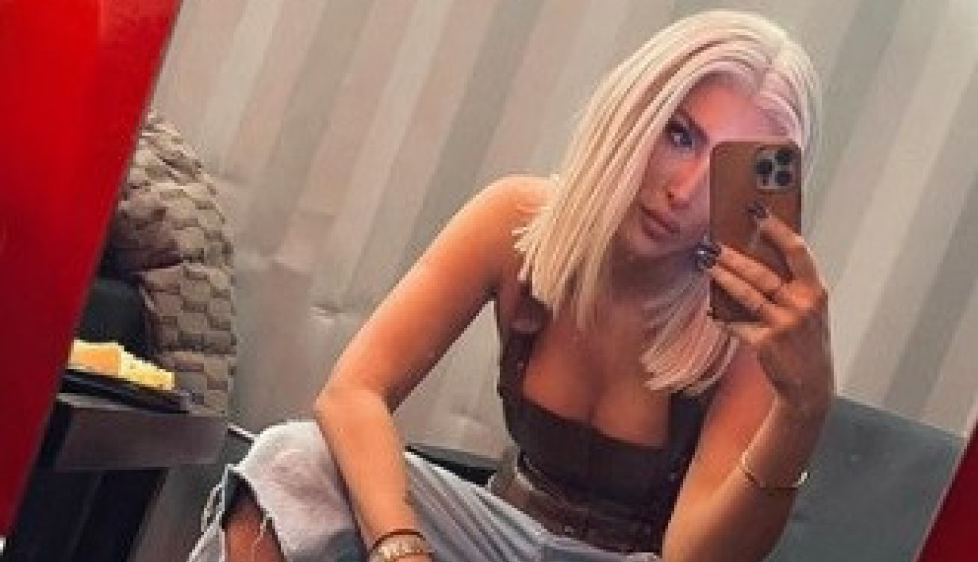 SENIDA POKAZALA DUBOK DEKOLTE, a ispod grudi izvirili flasteri, svi se pitaju šta joj se desilo? (FOTO)