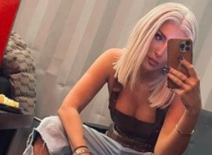 SENIDA POKAZALA DUBOK DEKOLTE, a ispod grudi izvirili flasteri, svi se pitaju šta joj se desilo? (FOTO)