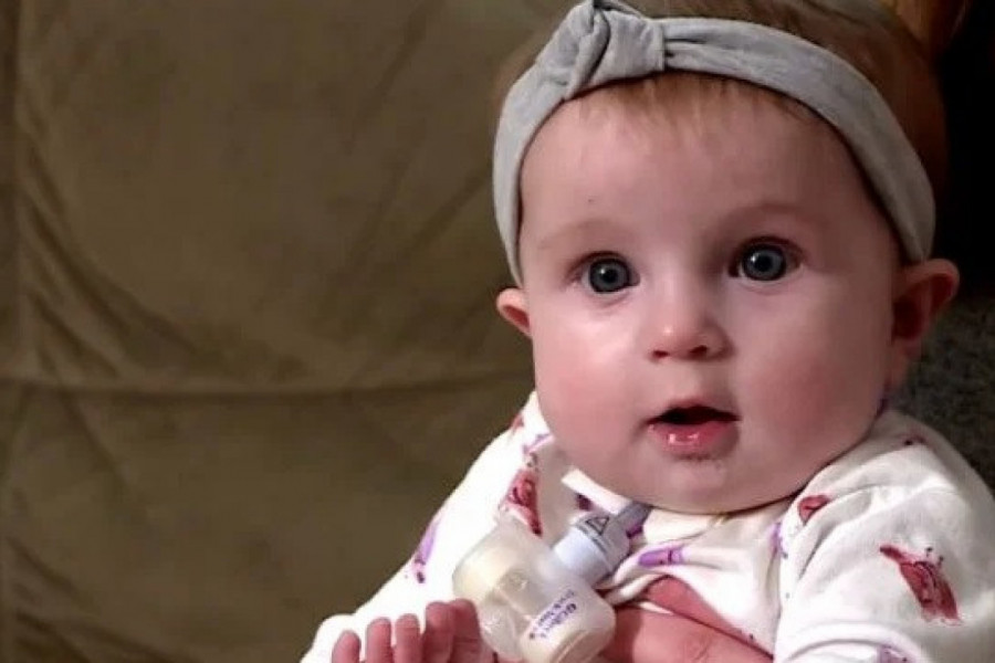 KADA SE RODILA OVA BEBA KONSTATOVANO JE SAMO DA IMA MNOGO KOSE: Niko nije obratio pažnju na to zašto ona ne ispušta glas, usledio je šok! (VIDEO)