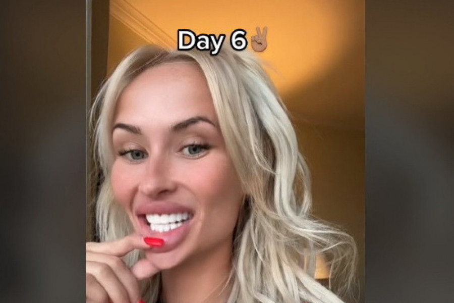 CURILA MI JE KRV IZ USTA I ZUBI SU MI LETELI NA SVE STRANE! Ovo vam niko neće reći o proceduri ugradnje turskih zuba, ali ja ću ispričati sve!