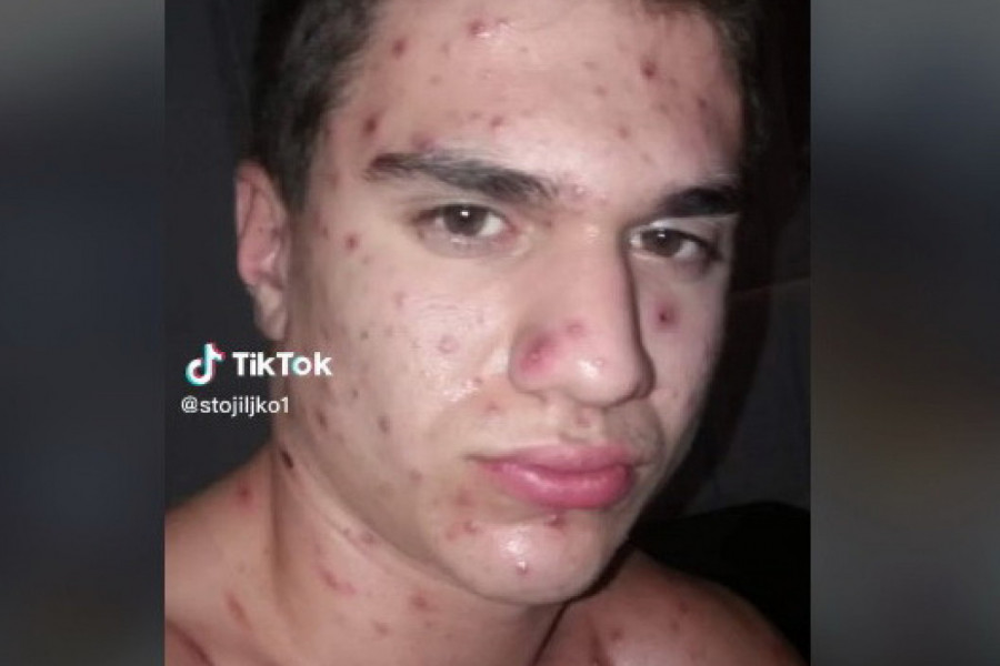 OTKRIO KAKVO OBOLJENJE JE DOBIO, PA NAKON TOGA OTIŠAO U TERETANU: Reakcija javnosti bila je brutalna, komentari se samo nižu  (VIDEO)