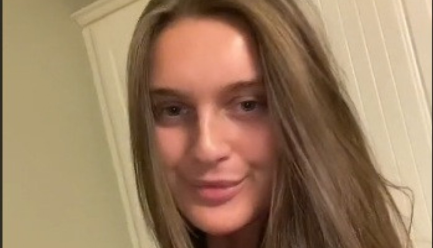 ŽELELA JE DA SE OTARASI FILERA IZ USANA, A ONDA JE GLAVA POČELA DA JOJ RASTE: Nije ni slutila da je ovo moguće, potresan snimak podelila je sa svetom (VIDEO)