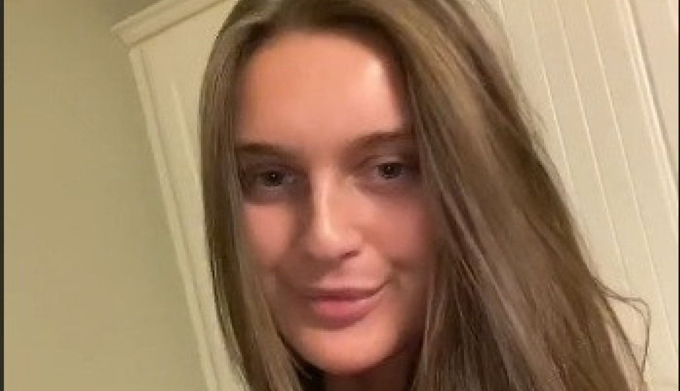 ŽELELA JE DA SE OTARASI FILERA IZ USANA, A ONDA JE GLAVA POČELA DA JOJ RASTE: Nije ni slutila da je ovo moguće, potresan snimak podelila je sa svetom (VIDEO)