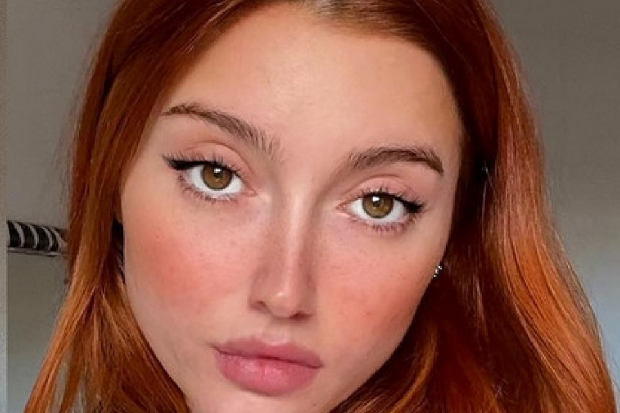 POZNATA INFLUENSERKA OTKRILA KAKO JOJ LICE IZGLEDA BEZ FILTERA I ZAPANJILA SVET: Govore mi da nikad neće naći dečka koji bi me poljubio u ovo (FOTO)