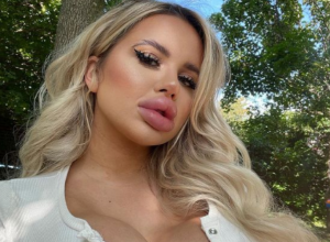 UGRADILA NAJVEĆE SILIKONSKE GRUDI I SNIMILA SE KAKO TRČI! Fanovi zabrinuti: Pa sve će joj pući! (FOTO/VIDEO)