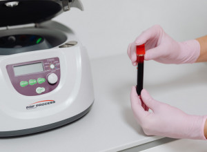 NE ZNATE KOJA STE KRVNA GRUPA? 3 jednostavna načina da to otkrijete očas posla!