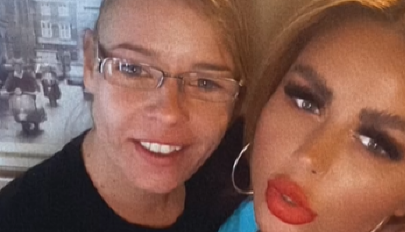 POSLE UŽASA KOJE SU OVE DVE DEVOJKE PREŽIVELE, STOMATOLOG PROGOVORIO O TURSKIM ZUBIMA: Bol im ne prestaje već 4 meseca, u pitanju je kobna greška! (FOTO/VIDEO)