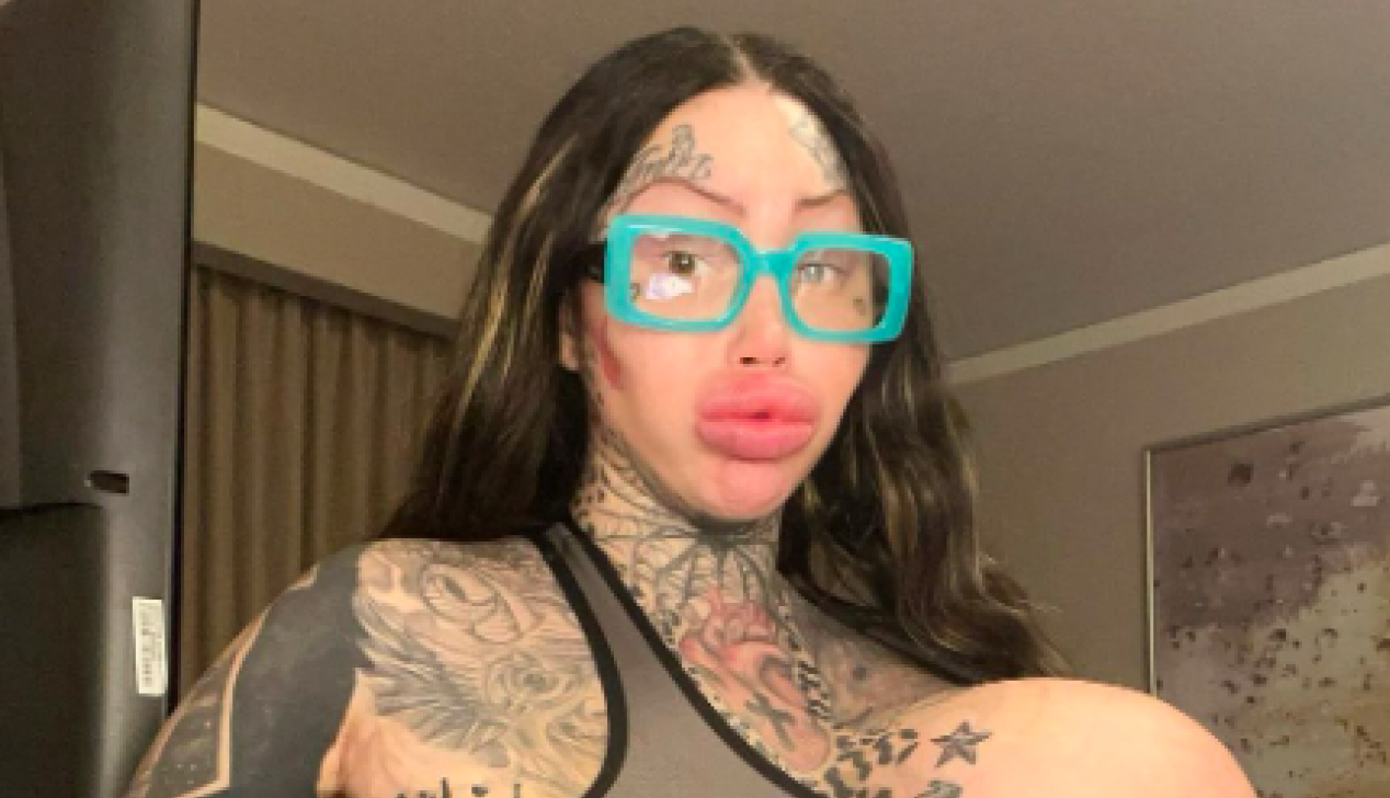 IMALA JE NAJVEĆE SILIKONSKE GRUDI A ONDA JE SVE PUKLO: Unakažena Marija hitno otišla kod lekara koji joj je dao zastrašujuću prognozu (FOTO/VIDEO)