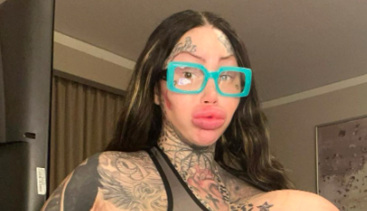 IMALA JE NAJVEĆE SILIKONSKE GRUDI A ONDA JE SVE PUKLO: Unakažena Marija hitno otišla kod lekara koji joj je dao zastrašujuću prognozu (FOTO/VIDEO)