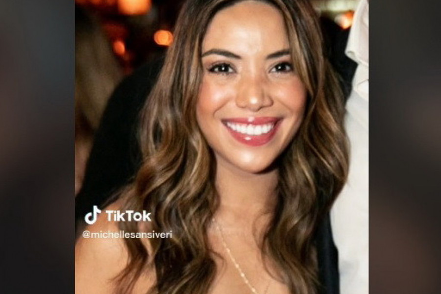 BILA JE LEPOTICA KOJOJ SE DIVE A ONDA JE DOBILA OBOLJENJE KOJE JOJ JE UNIŠTILO LICE i TELO: Mišel stiže podrška sa svih strana nakon snimaka koje je objavila (VIDEO)