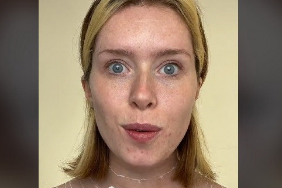 NAKON 27 SATI ŠMINKANJA LICE JE POČELO DA JOJ SE RASPADA: Poznata šminkerka otkrila kako joj koža sada izgleda (VIDEO)