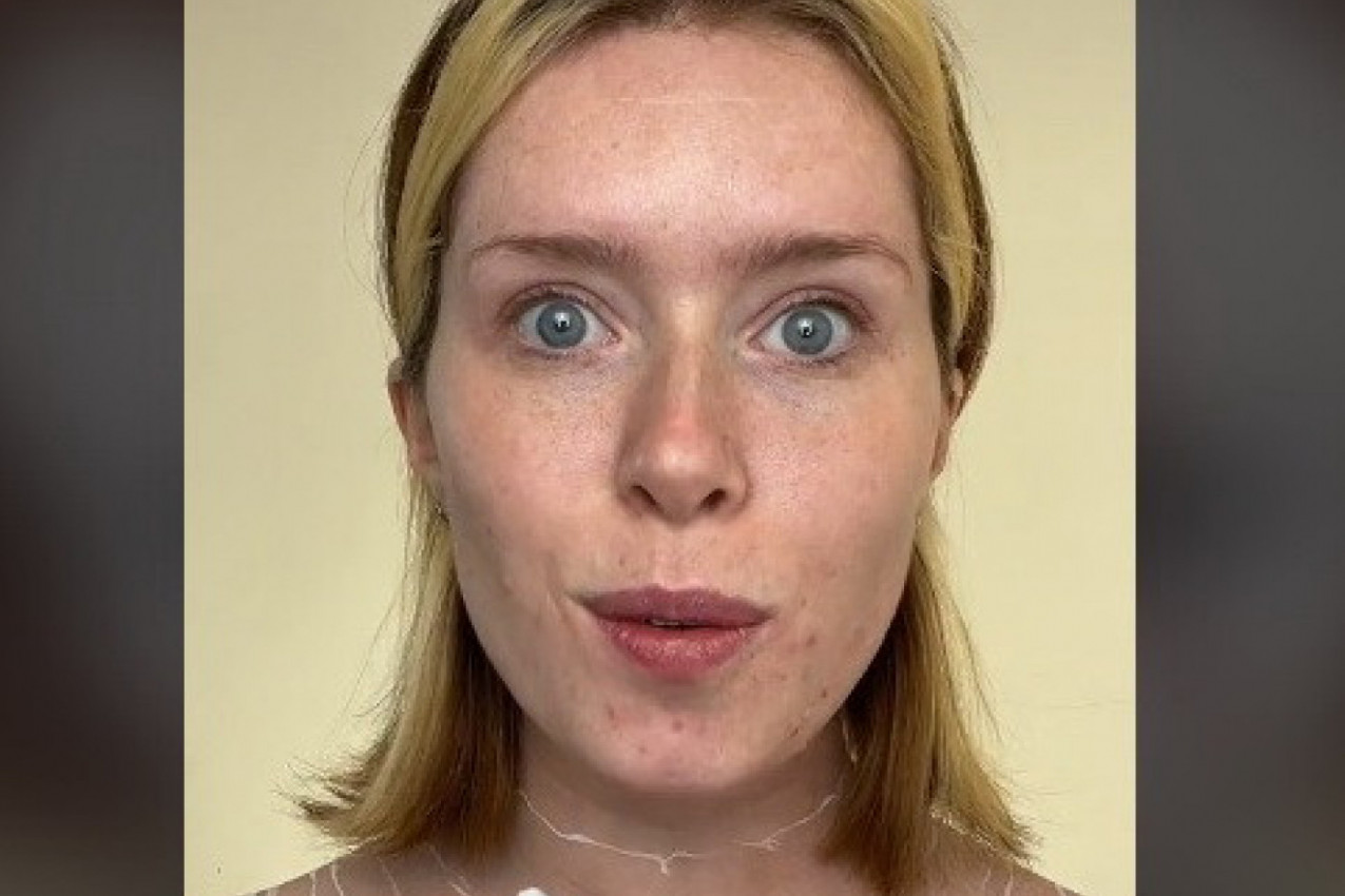 NAKON 27 SATI ŠMINKANJA LICE JE POČELO DA JOJ SE RASPADA: Poznata šminkerka otkrila kako joj koža sada izgleda (VIDEO)