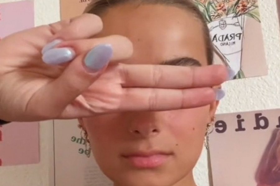 NJENE OČI SU TOLIKE DA SE MNOGI PRESTRAVE: Pričaju mi da sam ista vilenjak iz "Gospodar prstenova", misle da sam bolesna(VIDEO)