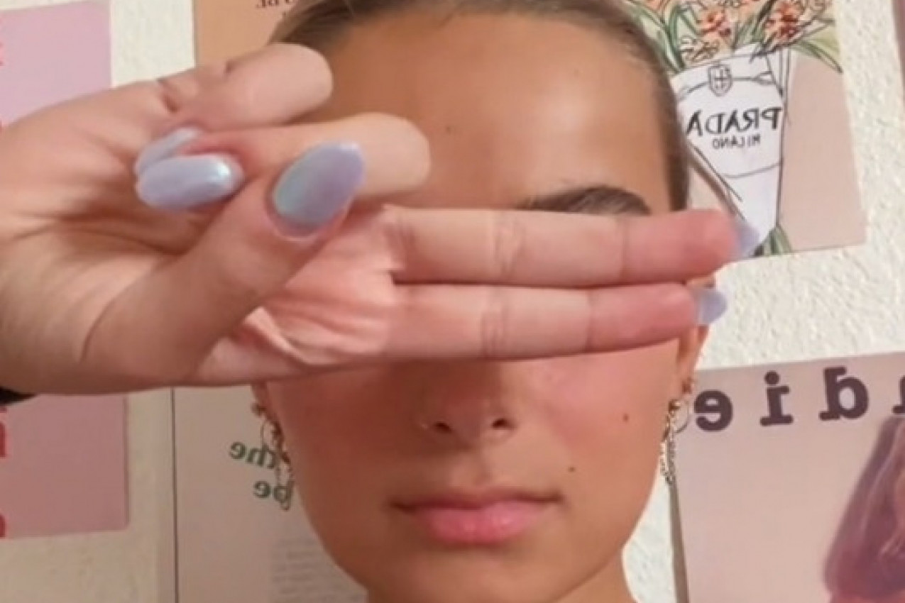 NJENE OČI SU TOLIKE DA SE MNOGI PRESTRAVE: Pričaju mi da sam ista vilenjak iz "Gospodar prstenova", misle da sam bolesna(VIDEO)