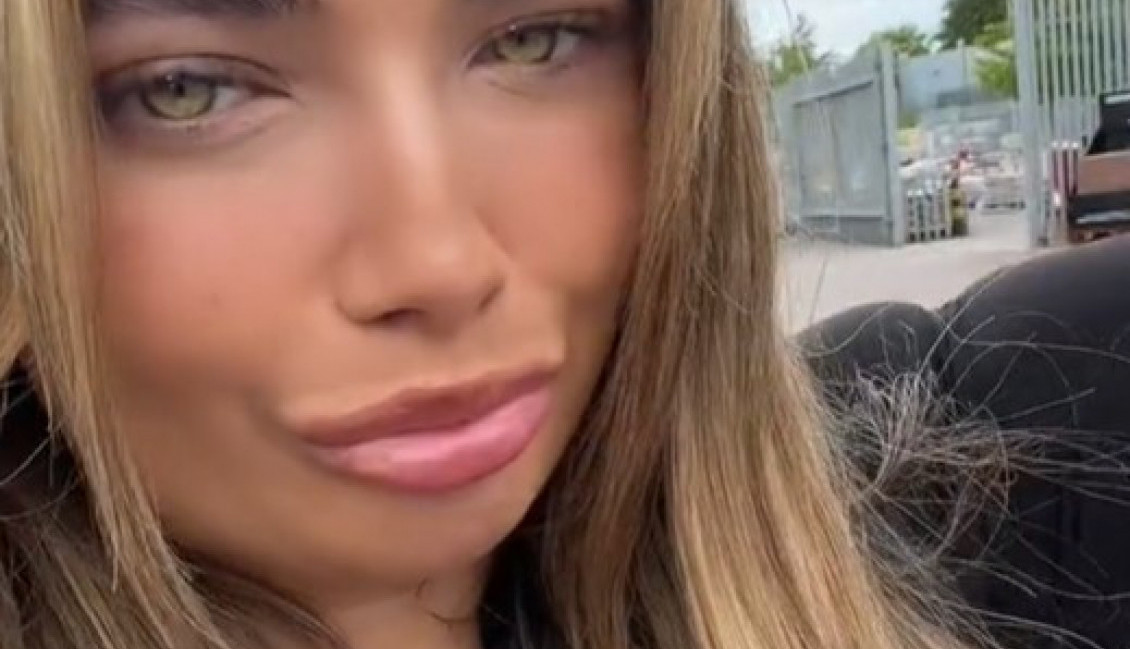 UDISALA JE SREDSTVO ZA POTAMNJIVANJE I IŠLA U SOLARIJUM: Posle par dana koža joj se dramatično promenila, strahuje od najgoreg (VIDEO)