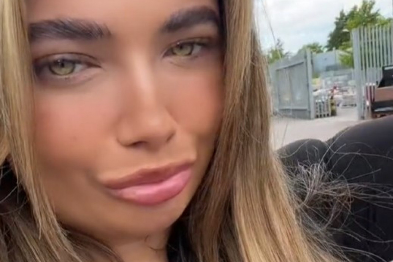 UDISALA JE SREDSTVO ZA POTAMNJIVANJE I IŠLA U SOLARIJUM: Posle par dana koža joj se dramatično promenila, strahuje od najgoreg (VIDEO)