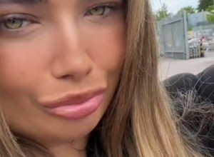 UDISALA JE SREDSTVO ZA POTAMNJIVANJE I IŠLA U SOLARIJUM: Posle par dana koža joj se dramatično promenila, strahuje od najgoreg (VIDEO)