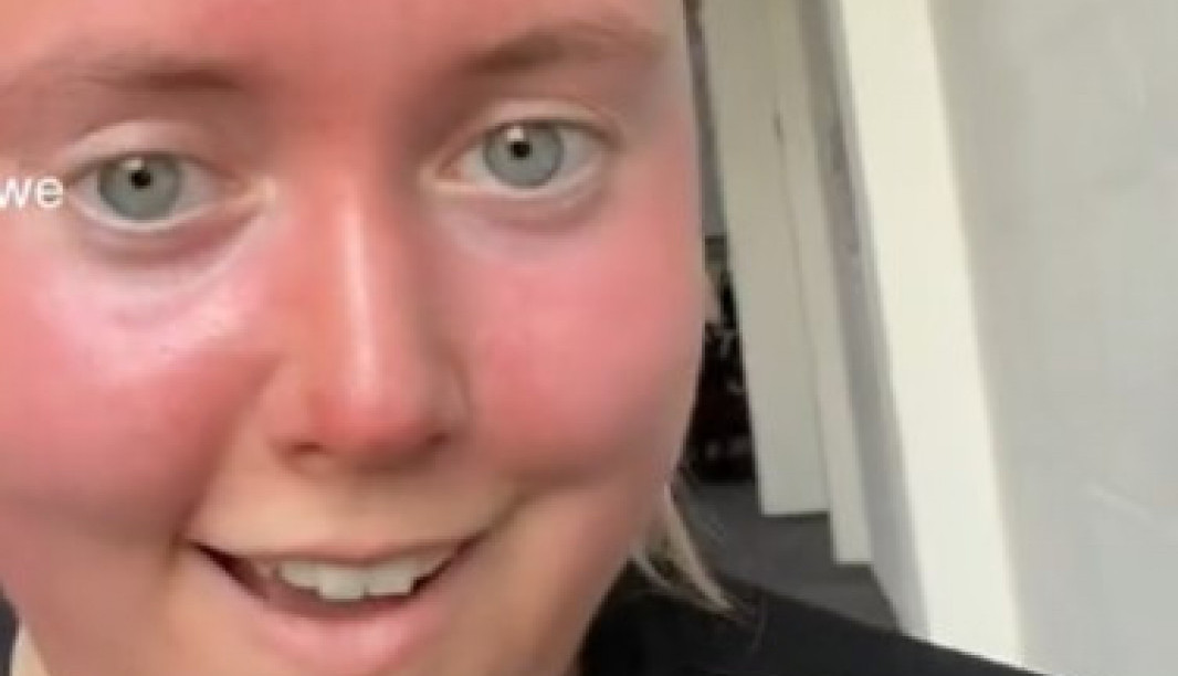 SVI SE PITAJU ŠTA SE DESILO OVOJ DEVOJCI: Čarlino lice izgleda zastražujuće zbog jedne stvari koju je sebi uradila (VIDEO)