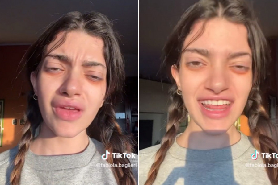 ŠTA SE DOGODILO POZNATOJ LEPOTICI? Ljudi ne veruju sopstvenim očima, da li je moguće da u stvari ovako izgleda?!