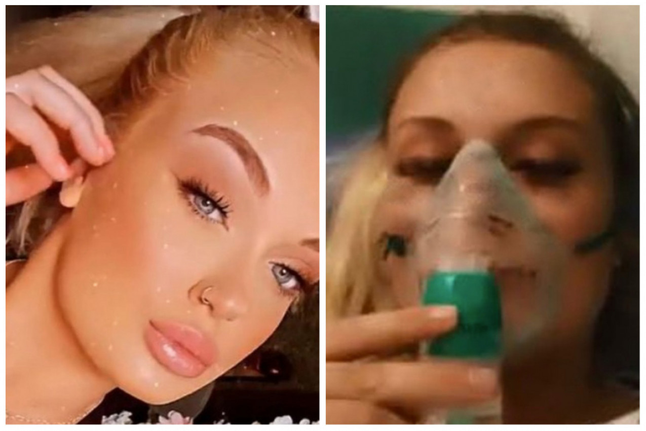 NIKAD NISAM PUŠILA SVE DOK SE NISAM NAVUKLA NA ELEKTRONSKE CIGARETE: A onda sam jednog jutra počela da se gušim, lekari su se zaprepastili kad su videli nalaz (FOTO)