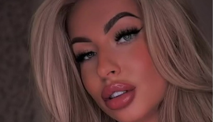 KAKO JE OVO MOGUĆE? Plavuša koja je zaludela pola planete pokazala kako je izgledala pre samo 4 godine! (FOTO)