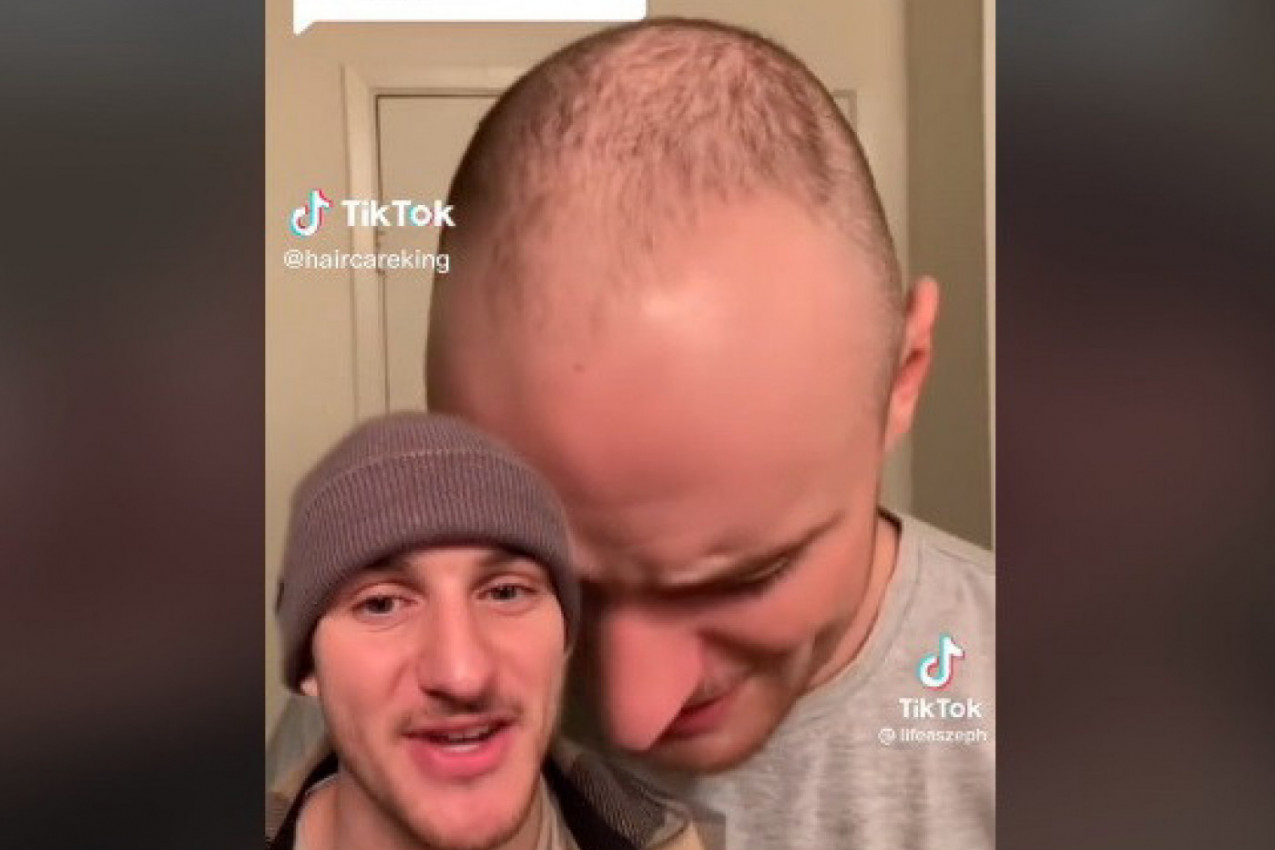 BRZINOM SVETLOSTI JE GUBIO KOSU,  A ONDA JE POČEO DA KORISTI ULJE RUZMARINA: Dogodila mu se promena kakvu nije mogao ni da sanja (VIDEO)