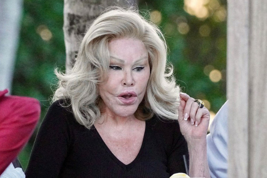 "ŽENA MAČKA" TVRDI DA NIKAD NIJE OPERISALA LICE! Objavila je i fotografiju iz mladosti da to i dokaže, ljudi u šoku kako je izgledala! (FOTO)