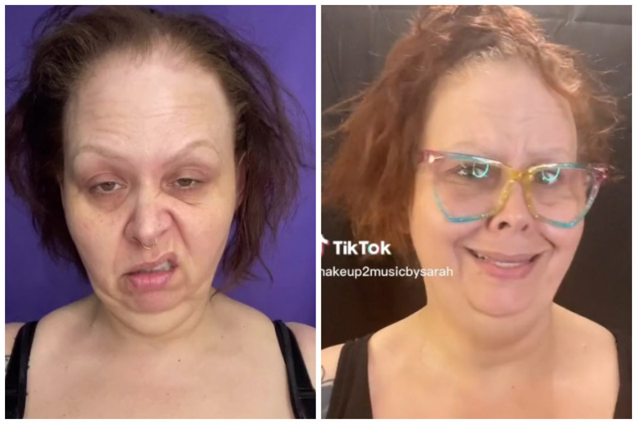 NJOJ SE KLANJAJU I ESTETSKI HIRURZI! Tvrde: Način na koji se ona transformiše mi ne bismo ni blizu mogli da joj pružimo! (VIDEO)