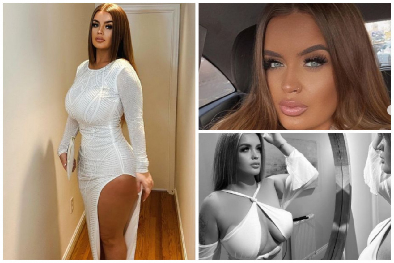 POSTALA JE MILIONERKA SA 17 GODINA A ONDA SPISKALA NOVAC NA SILIKONE: Lepotica jedva ostala živa nakon operacije u Turskoj, evo kako sada izgleda (FOTO)